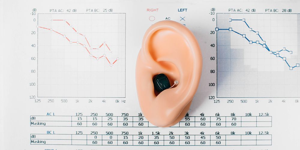audiogramma orecchio apparecchio acustico