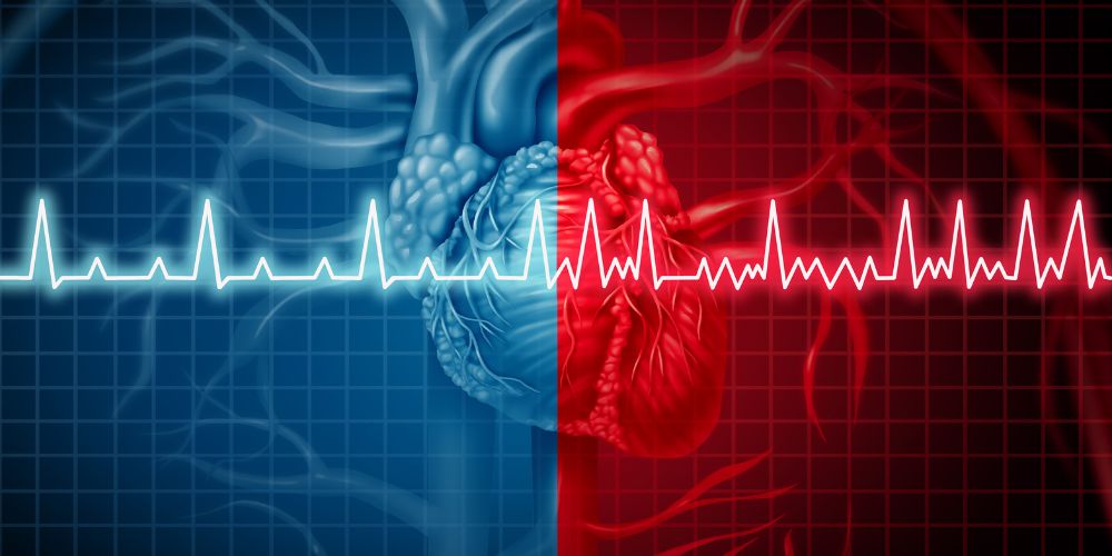 NEGLI ANZIANI AUMENTA L’INCIDENZA DELLA FIBRILLAZIONE ATRIALE